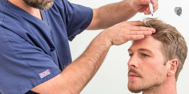 How To Choose a Hair Restoration Method