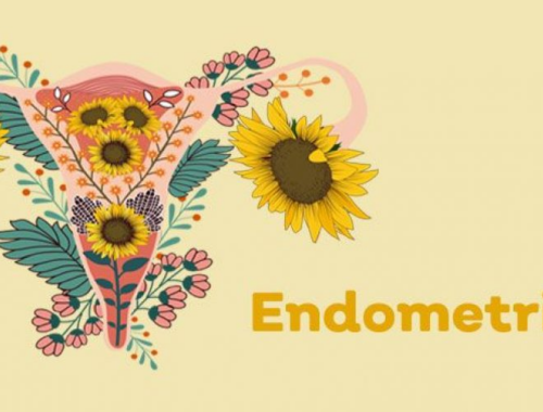 How Endometriosis Affects Embryo Implantation